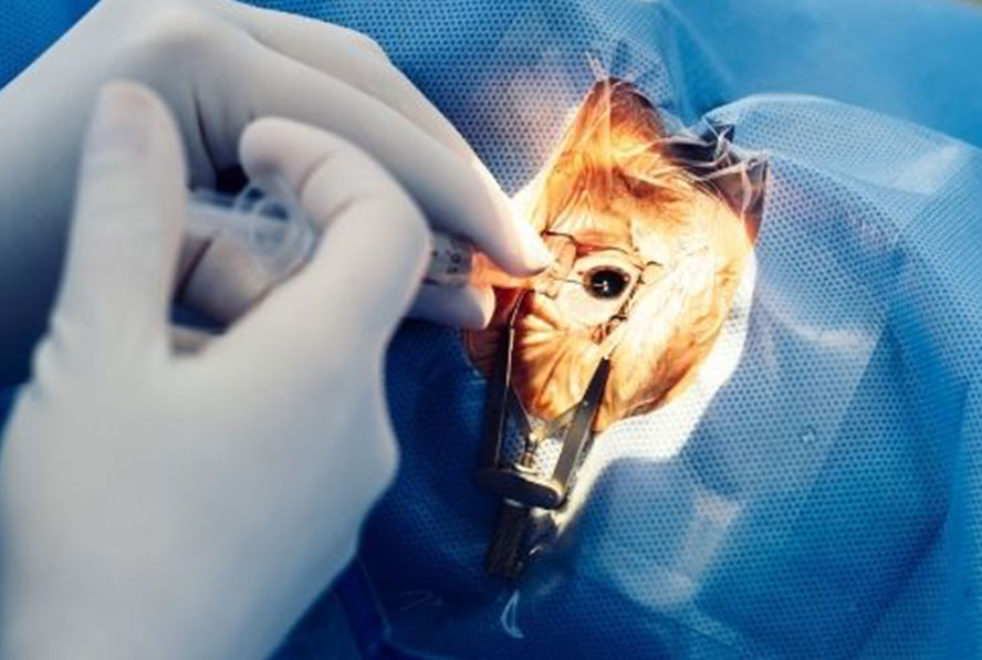 Breast Clinic, Wanowarie - Ruby Hall Clinic